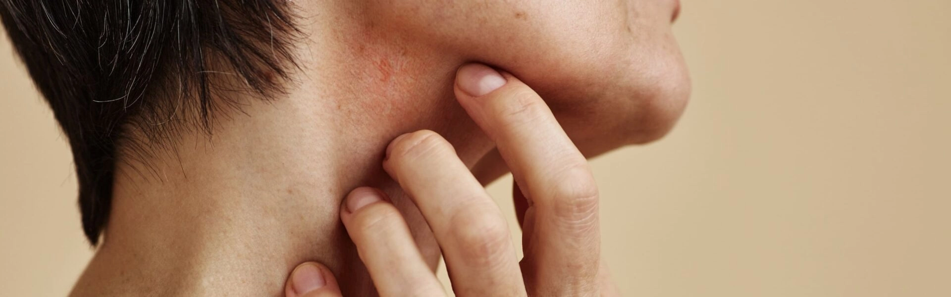 Peaux atopiques